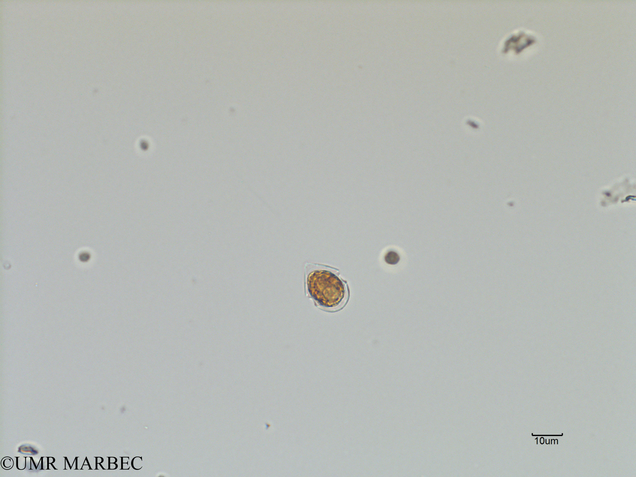 phyto/Scattered_Islands/iles_glorieuses/SIREME November 2015/Scrippsiella spp (SIREME-Glorieuses2015-ech1-171116-Scrippsiella-3)(copy).jpg